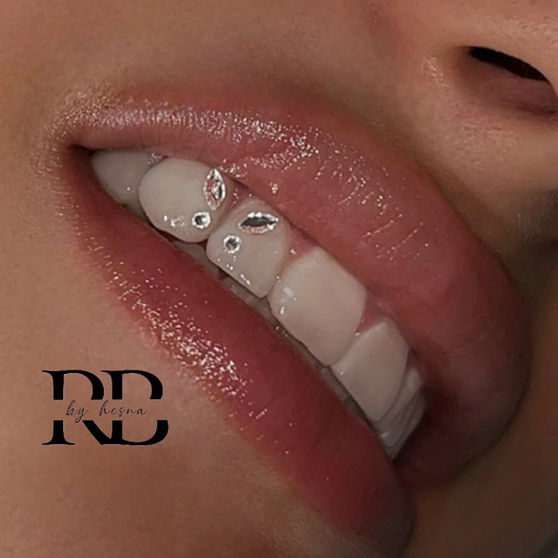 Zahnschmuck mit Swarovski Kristallen